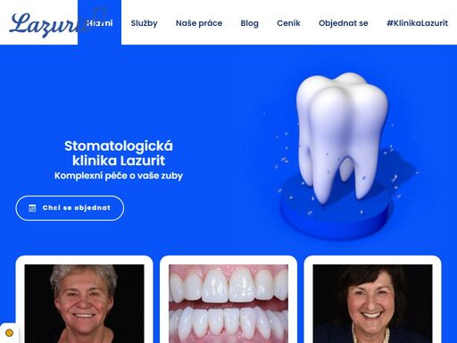špičkové stomatologické služby a nejmodernější přístup k rekonstrukci chrupu. kvalitní implantáty, moderní technologie a důraz na estetiku.
