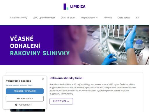 www.lipidica.cz