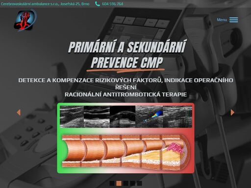 neurologická ambulance, specializující se na primární i sekundární prevenci cévních mozkových příhod a na neurosonologickou diagnostiku (ultrazvukové vyšetření krčních a mozkových tepen).