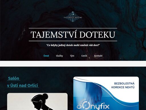 !!novinka v salónu od 24.4.25 aplikace špon od systému onyfix na zarostlé nebo deformované nehty !! jedná se o zdravotnický prostředek, určen jen pro profesionální použití.