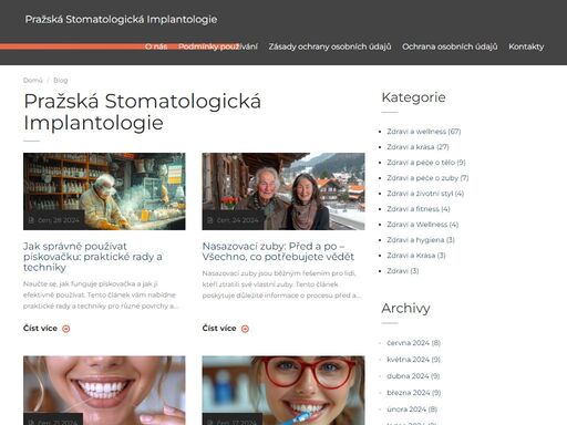 stomatochirurgie-implantaty-praha.cz